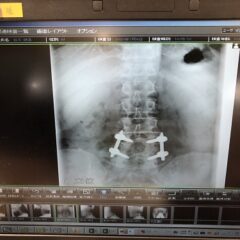 お風呂であの痛みが！