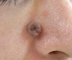 秘密のクレイパック術