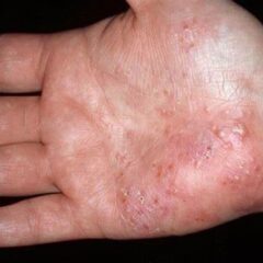 傷口からバイ菌「慧一之水　えいちの水　エイチの水」