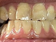 俺の悩み・・・😖